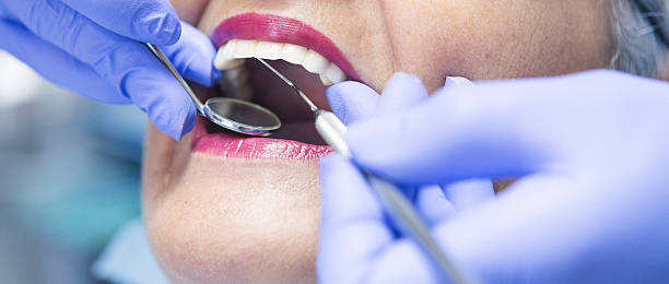 Best Emergency Tooth Extraction in Gorman, TX